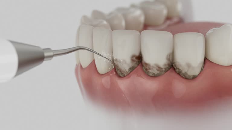 Trusted Tooth Extraction service in Benson, NC - Dentist Open Now
